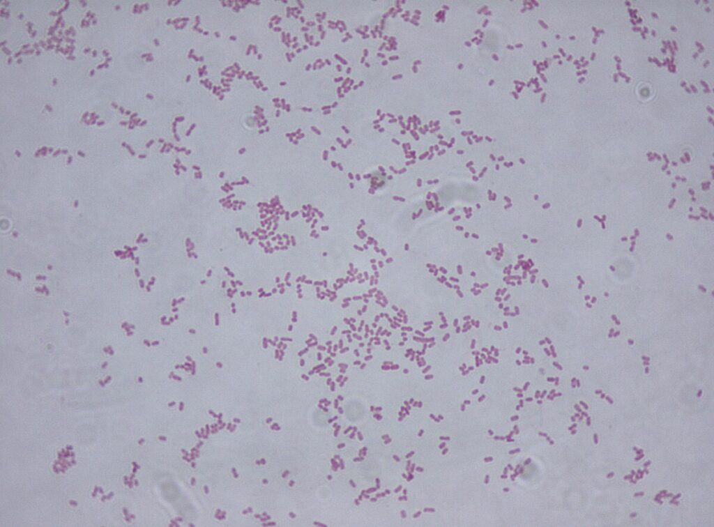 Klebsiella Oxytoca