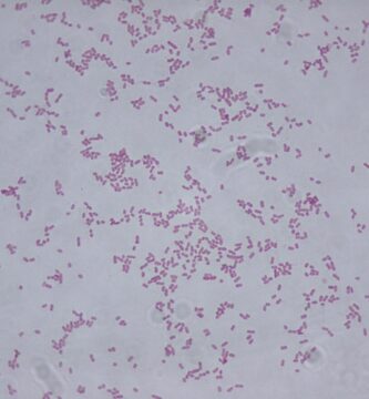 Klebsiella Oxytoca